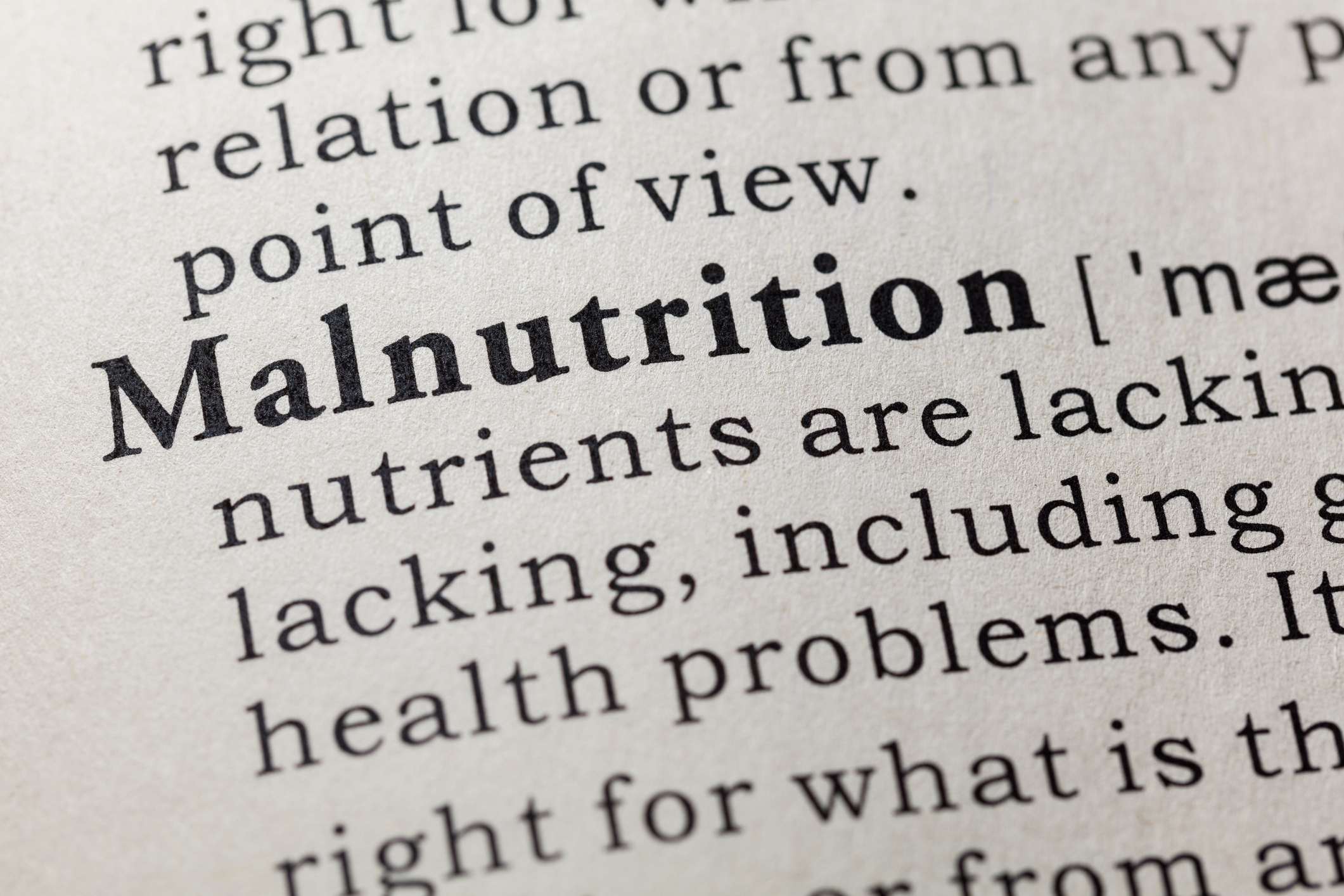 Lancet study highlights ‘shocking’ malnutrition findings